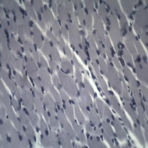 BS-2030M Monocular Biological Microscope