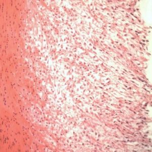 BS-2030M Monocular Biological Microscope
