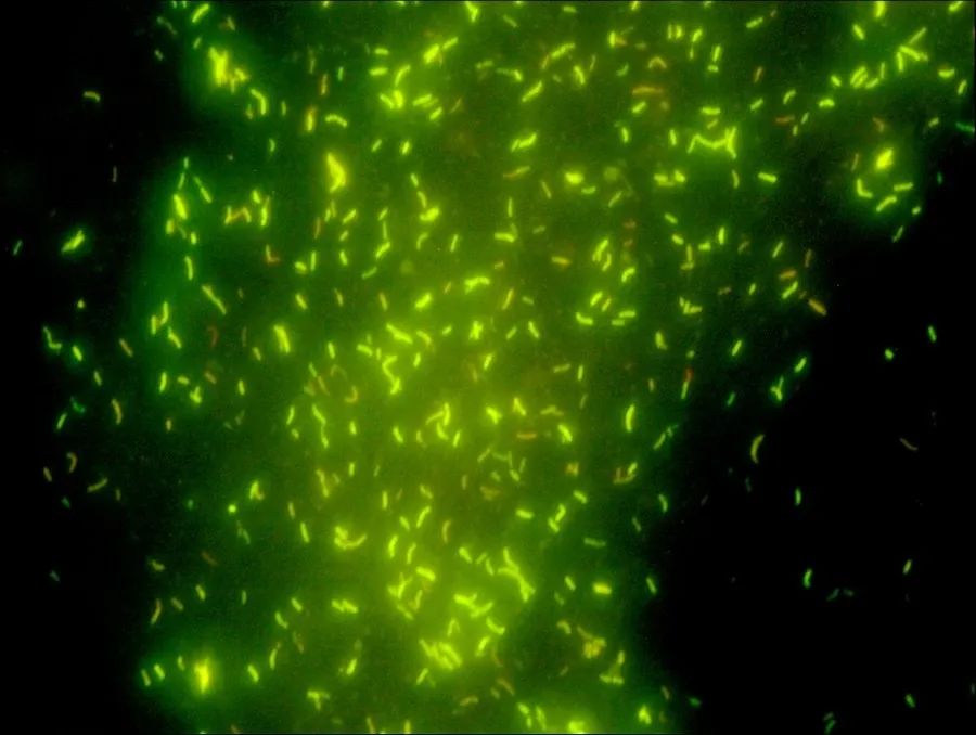 The Auramine-O fluorescent staining method
