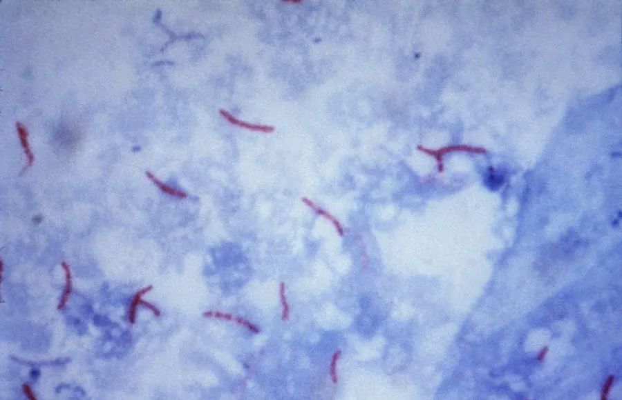 The Ziehl-Neelsen staining method