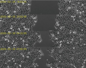 Continuous Time Lapse Acquisition