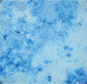 Nissl staining