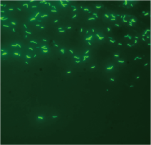 Auramine O staining