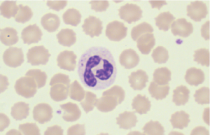 Blood cell morphology analysis