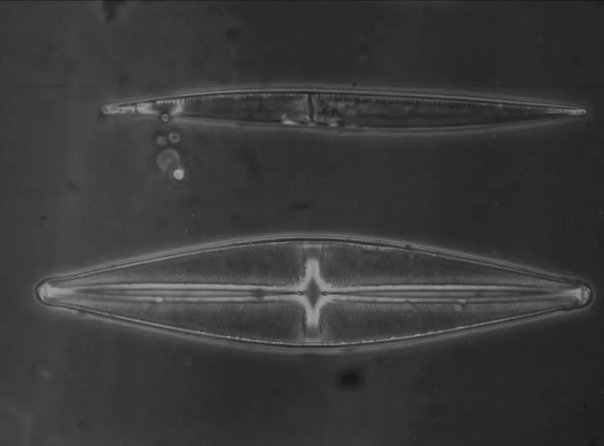 Diatom – Phase Contrast