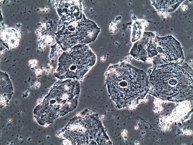 Oral Epithelial Cells – Phase Contrast