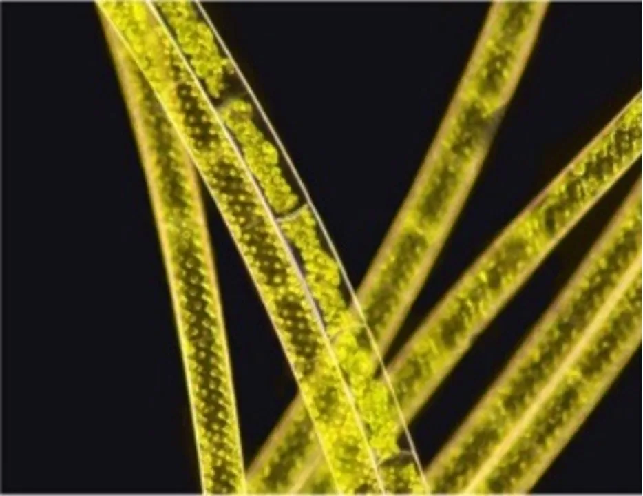 Spirogyra – Dark Field-