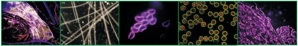 What is Dark Field Microscopy Used for