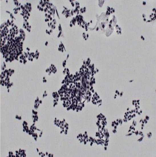 BS-3060FC Fluorescent Stereo Microscop