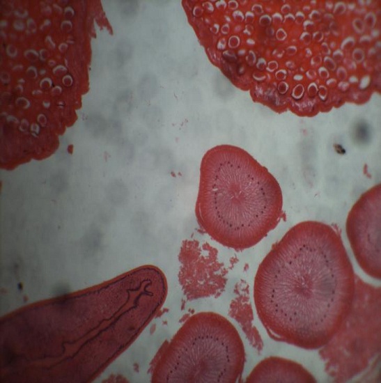 BS-2022B Binocular Biological Microscope