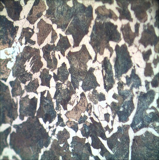 BS-6000AT Trinocular Metallurgical Microscope