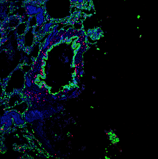 BCF295 Laser Scanning Confocal Microscopy