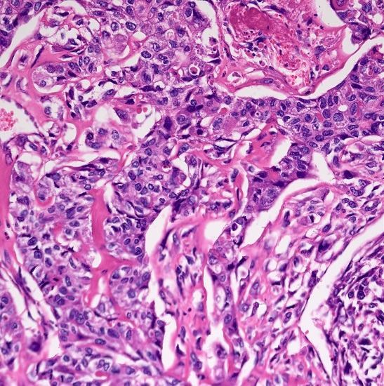 BLM2-274 LCD Digital Biological Microscope