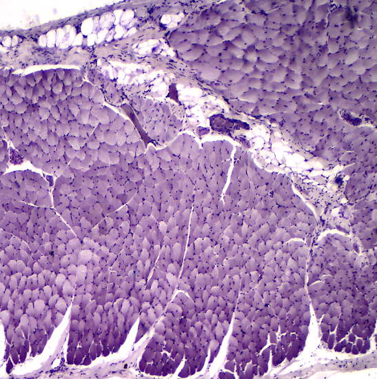 BLM2-241 LCD Digital Biological Microscope