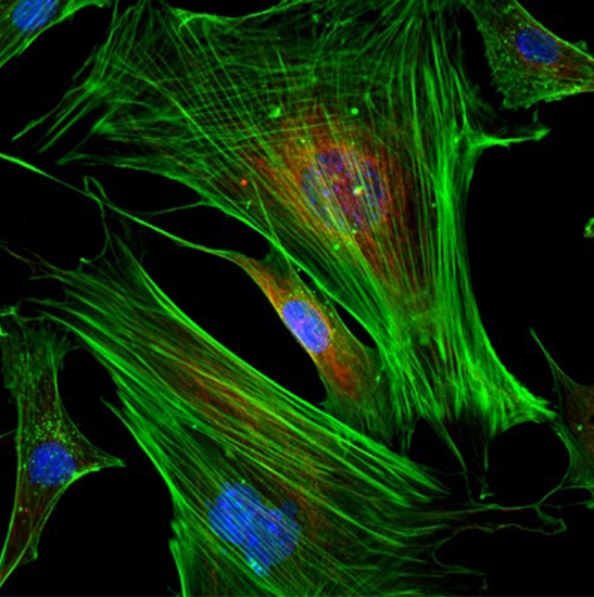 BS-2094CF LED Fluorescent Inverted Biological Microscope