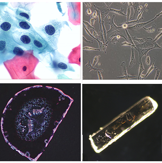 BS-2043BD1 LCD Digital Biological Microscope