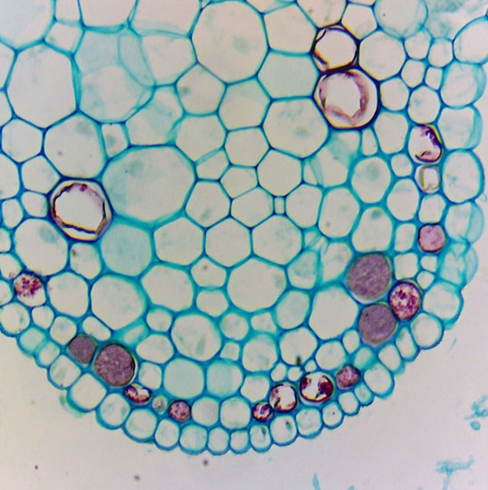BS-2040T Trinocular Biological Microscope