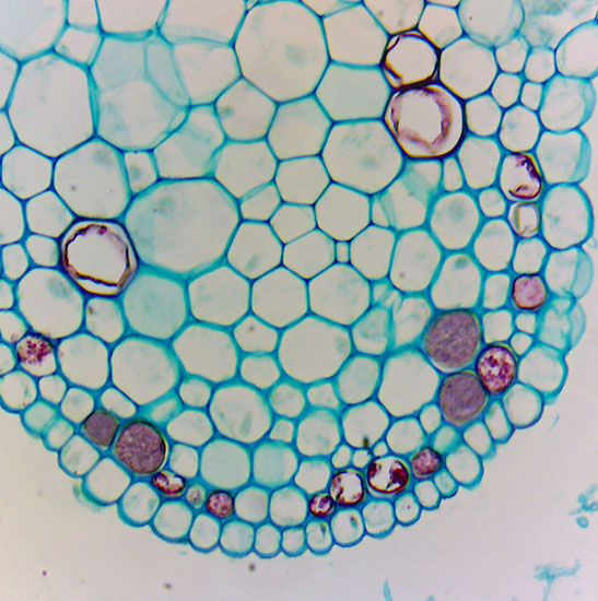 BLM-205 LCD Digital Biological Microscope