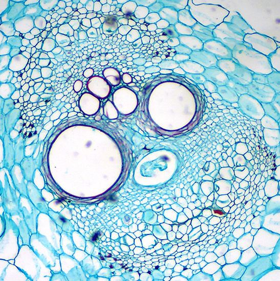 BLM-205 LCD Digital Biological Microscope