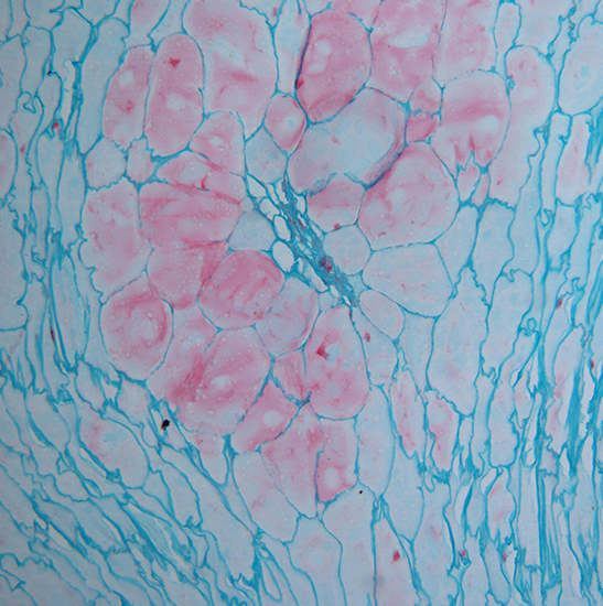 BLM-205 LCD Digital Biological Microscope