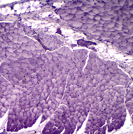 BS-2041T(DF) Trinocular Darkfield Biological Microscope