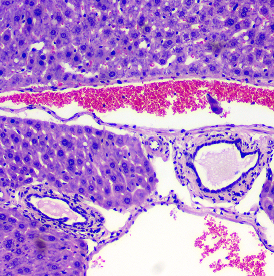 BS-2041B(DF) Binocular Darkfield Biological Microscope