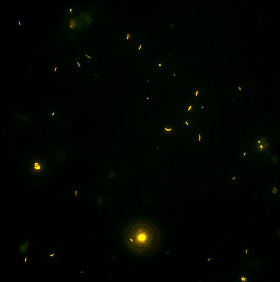 BS-2044FB Fluorescent Binocular Biological Microscope