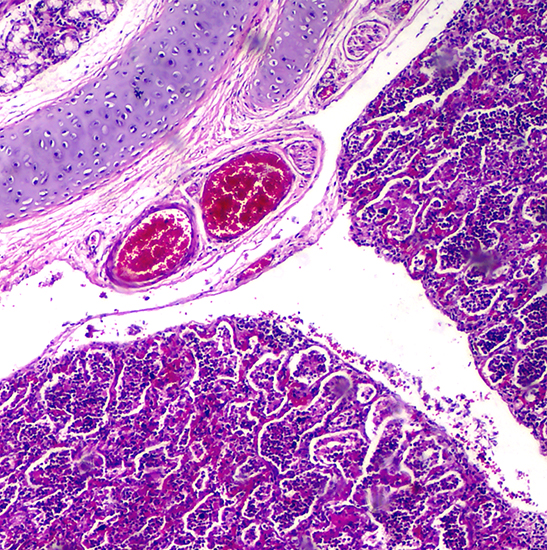 BS-2041T(DF) Trinocular Darkfield Biological Microscope