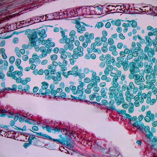 BS-2044B Binocular Biological Microscope