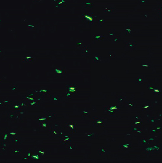 BS-2044FT(LED) LED Fluorescent Trinocular Biological Microscope