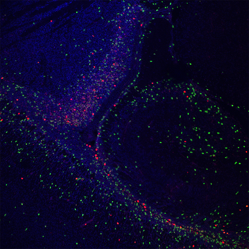 BCF297 Laser Scanning Confocal Microscopy