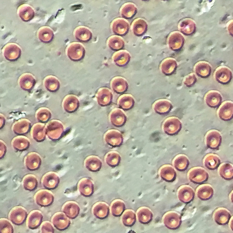 BS-2091 Inverted Biological Microscope