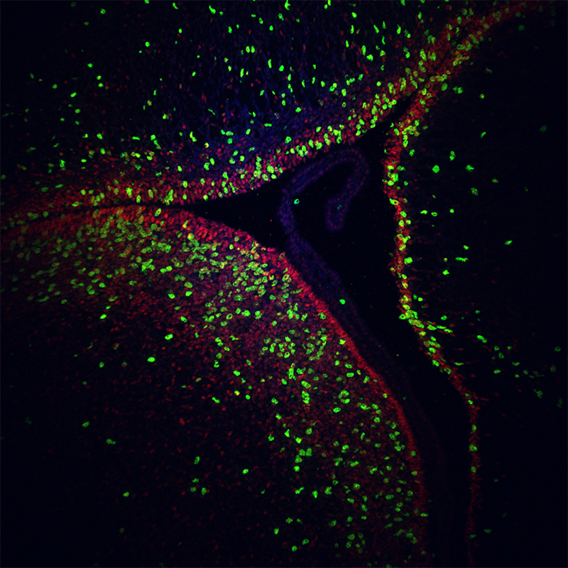 BCF297 Laser Scanning Confocal Microscopy