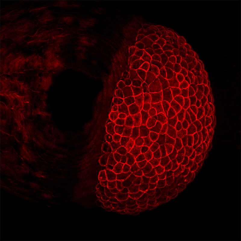 BCF297 Laser Scanning Confocal Microscopy