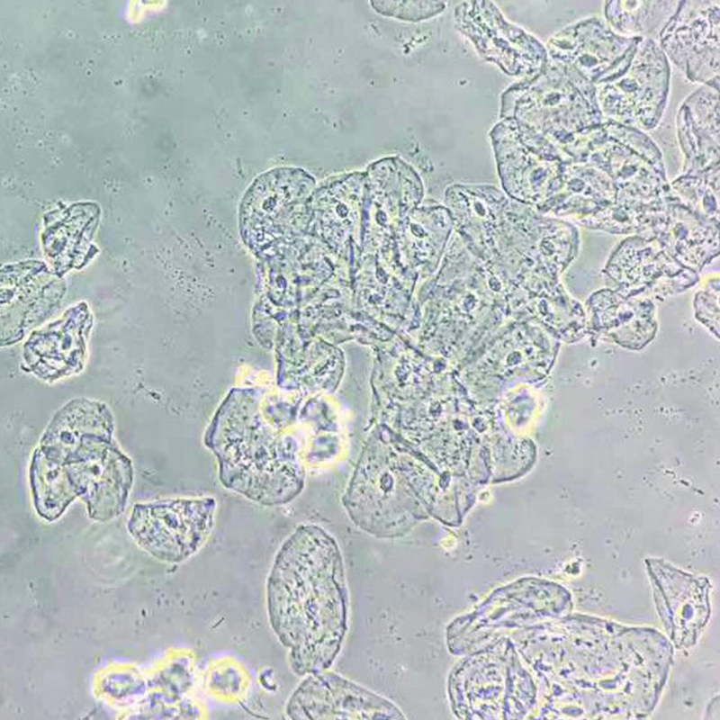 BS-2091 Inverted Biological Microscope