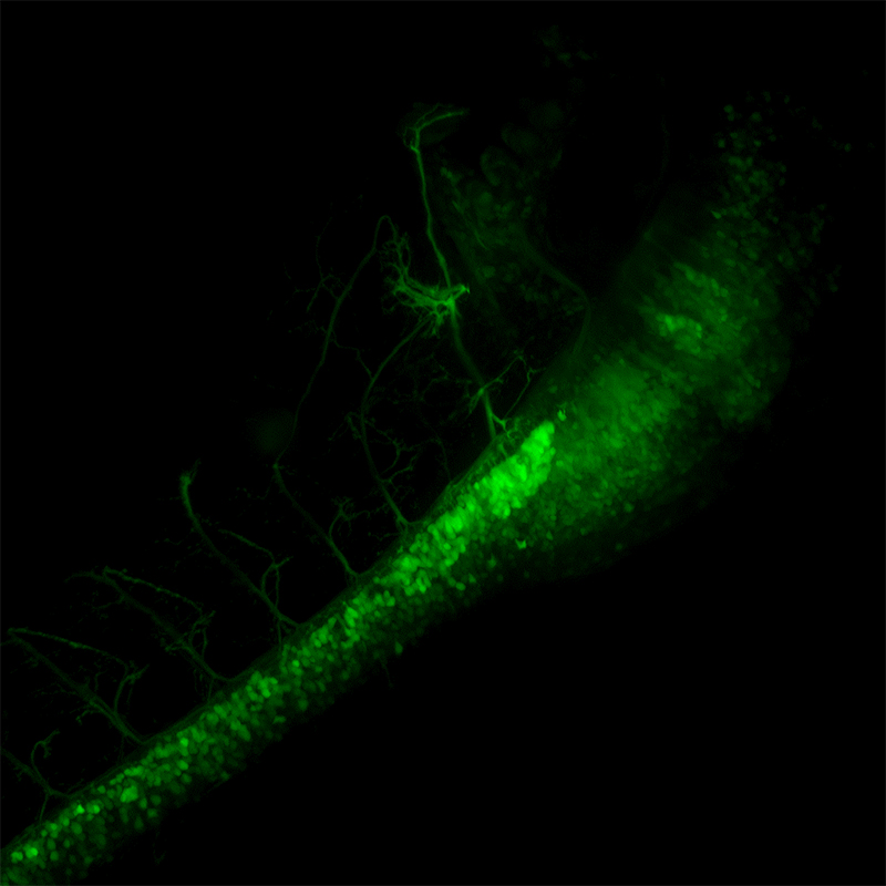 BCF297 Laser Scanning Confocal Microscopy