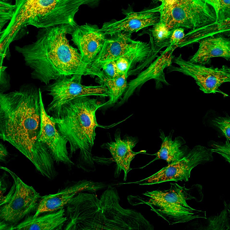 BS-2190A Inverted Biological Microscope