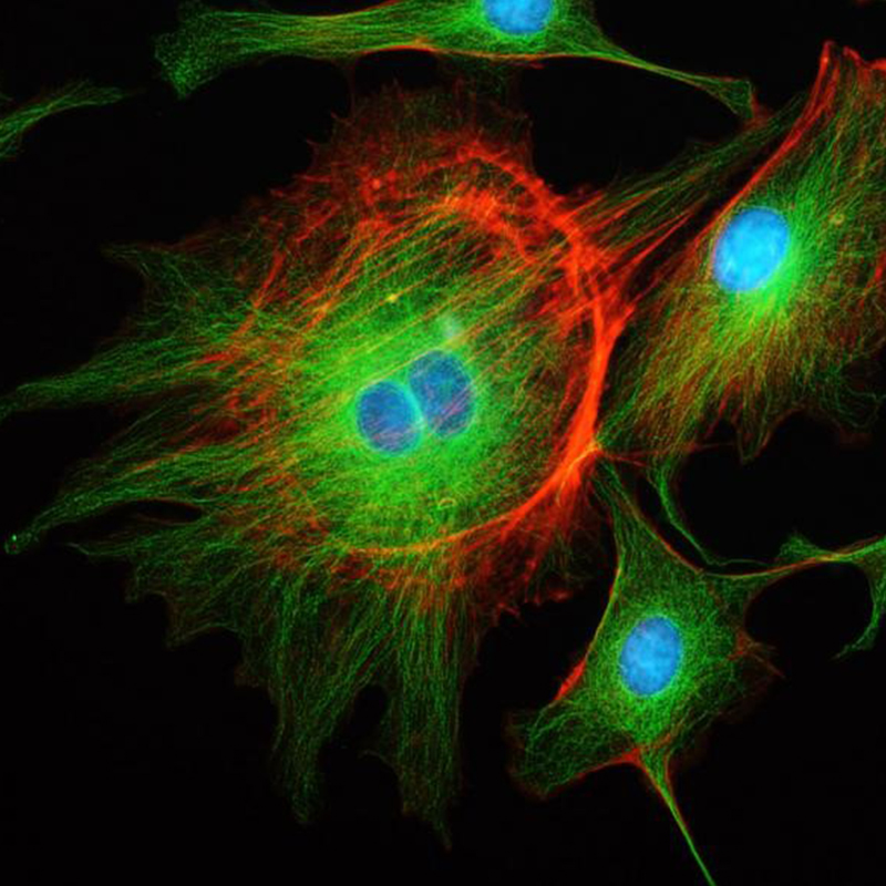 BS-2190B Inverted Biological Microscope