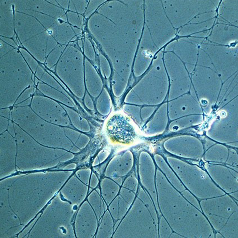 BS-2190AF Fluorescence Inverted Biological Microscope