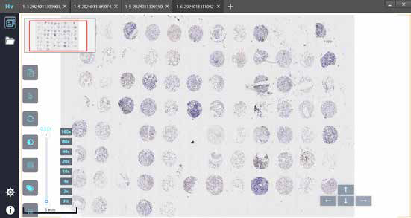 Scanpro2-6 Digital Pathology Section Scanner
