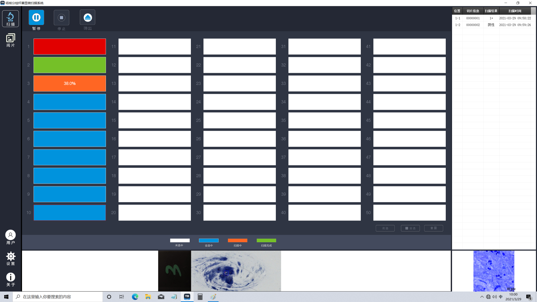 Scanpro 3-200FL Fluorescence Mycobacterium Tuberculosis Microscopy ...