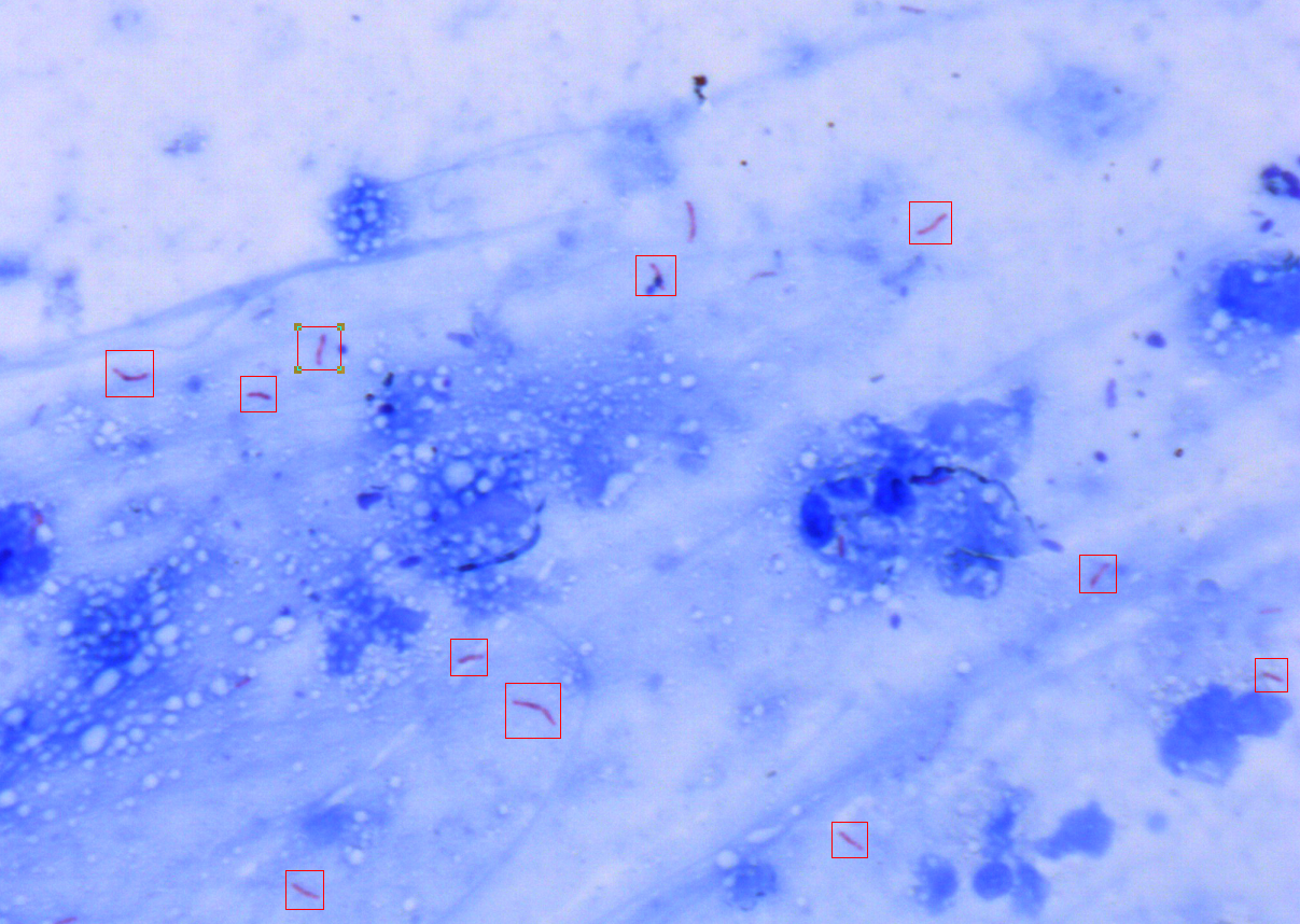 Scanpro 3-200 Mycobacterium Tuberculosis Microscopy Scanning System
