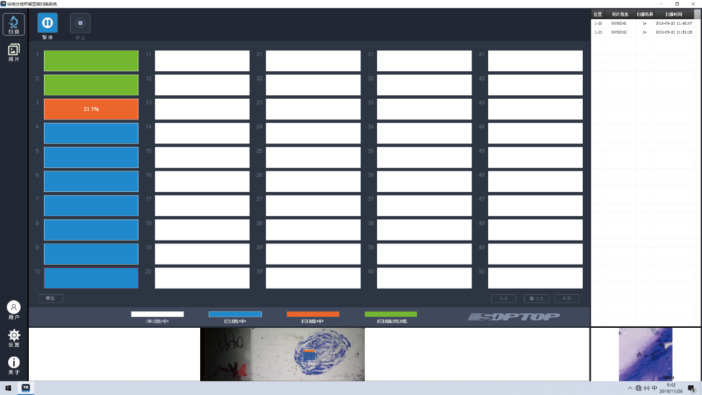 Scanpro 3-200 Mycobacterium Tuberculosis Microscopy Scanning System