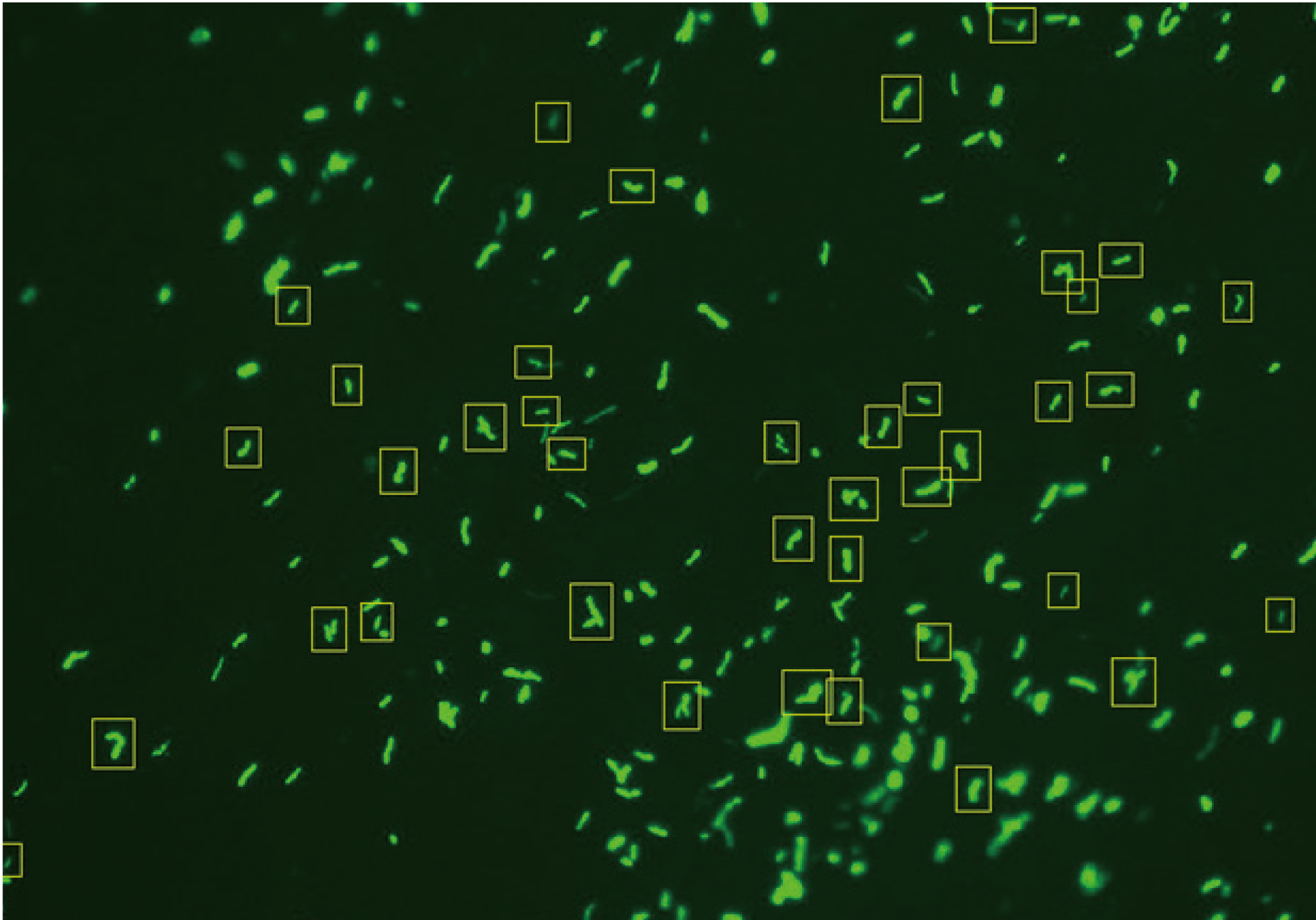 Scanpro 3-50 Mycobacterium Tuberculosis Microscopy Scanning System