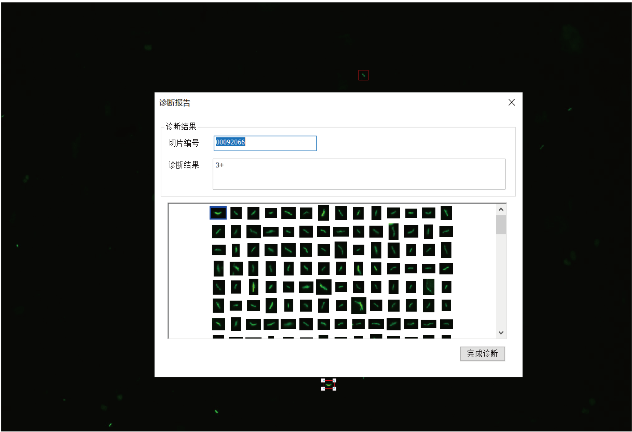 Scanpro 3-200 Mycobacterium Tuberculosis Microscopy Scanning System