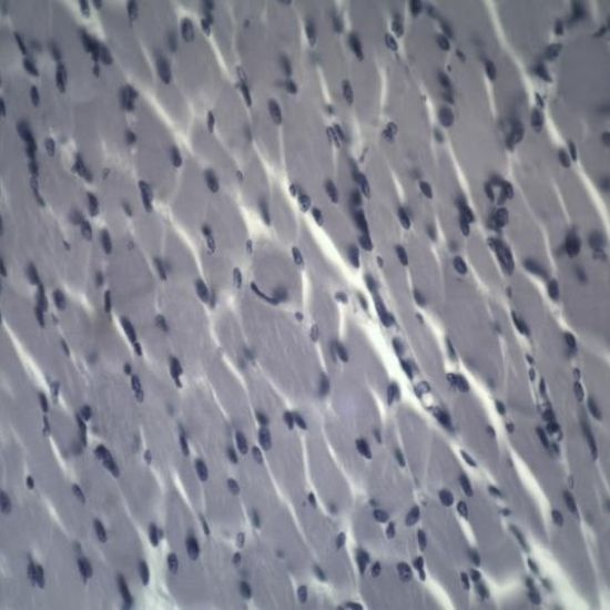 BS-2030M Monocular Biological Microscope