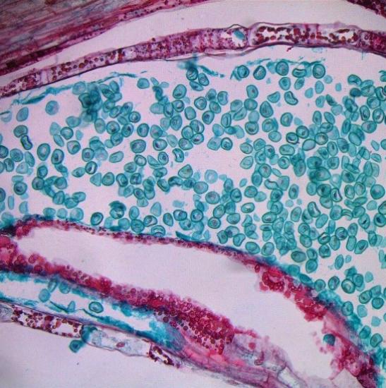 BS-2044FT Fluorescent Trinocular Biological Microscope