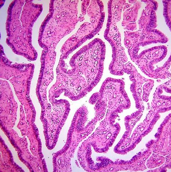 BS-2010F Trinocular Biological Microscope
