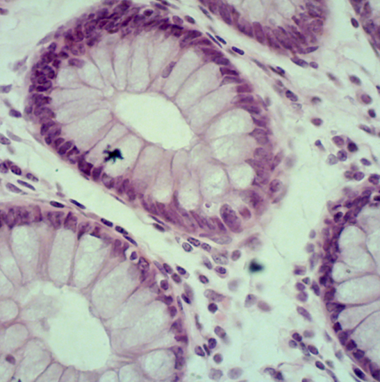 BS-2010F Trinocular Biological Microscope