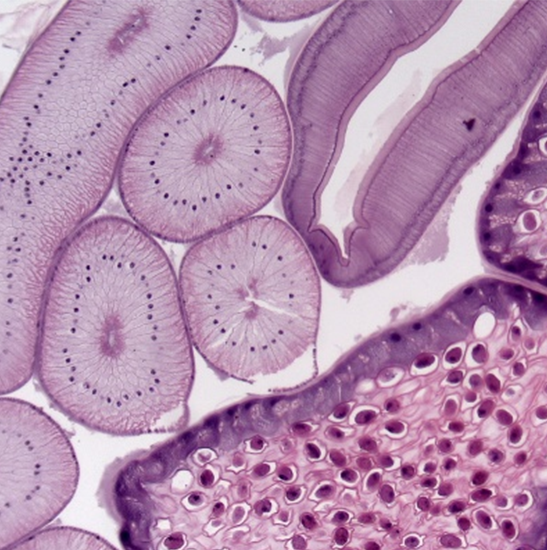 BLM5-227 LCD Digital Biological Microscope